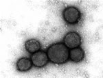 A型流感病毒
