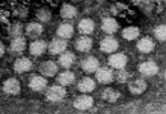 Noroviruses Takeshi Sanekata, PhD