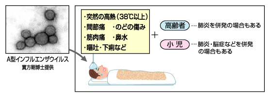 インフルエンザウイルスに感染すると