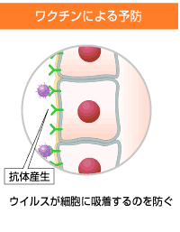 ワクチンによる予防