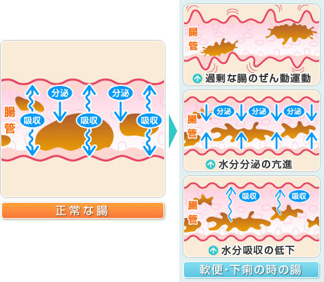 軟便・下痢のメカニズム図